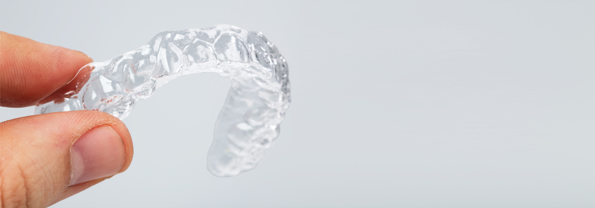 clear aligner