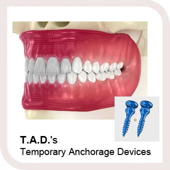 T.A.D.s - Temporary Anchorage Devices